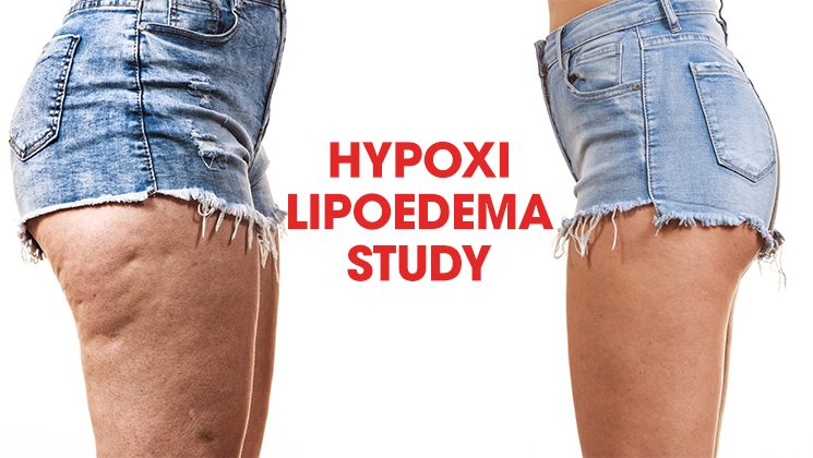 Blog - Hypoxi Usa